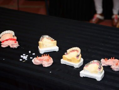 simpladentindia 3icci 10