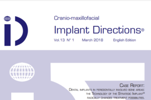 Implant Directions