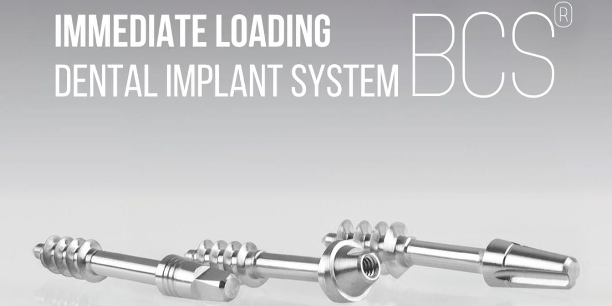 Immediate Loading Implants Immediate Loading Implants