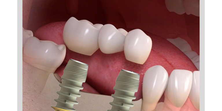 335388031_520952323317691_8938262309163263565_n