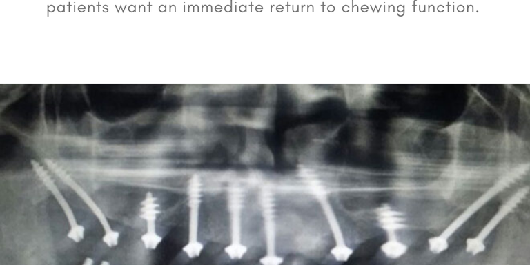 Basal Implantology Basal Implantology