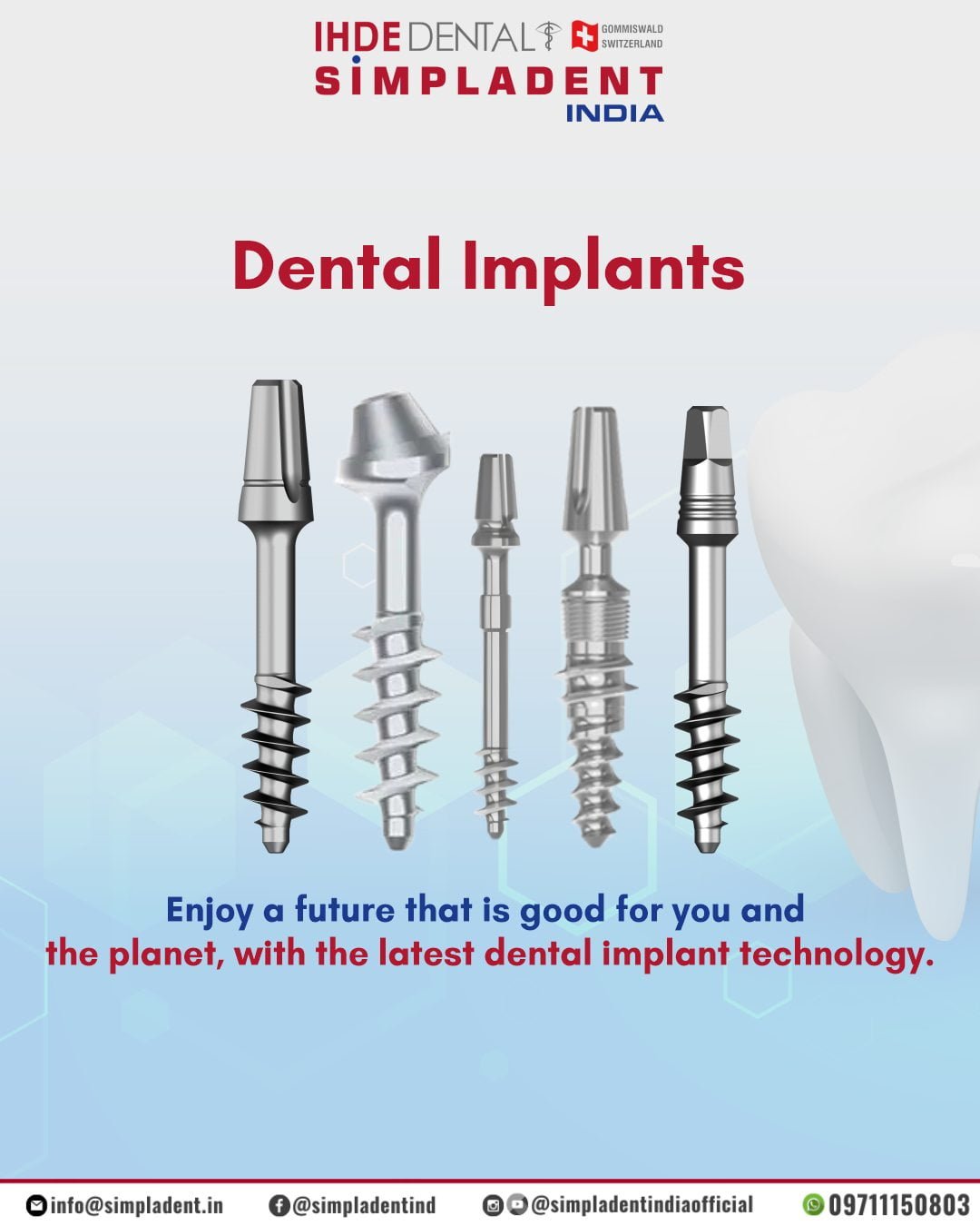 Dental Implants Dental Implants