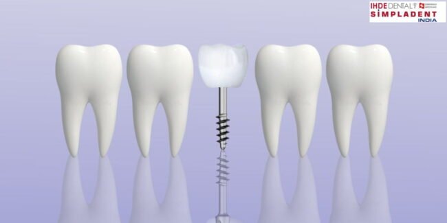 Premier Dental Implant Solutions: Leading the Way in India Premier Dental Implant Excellence India