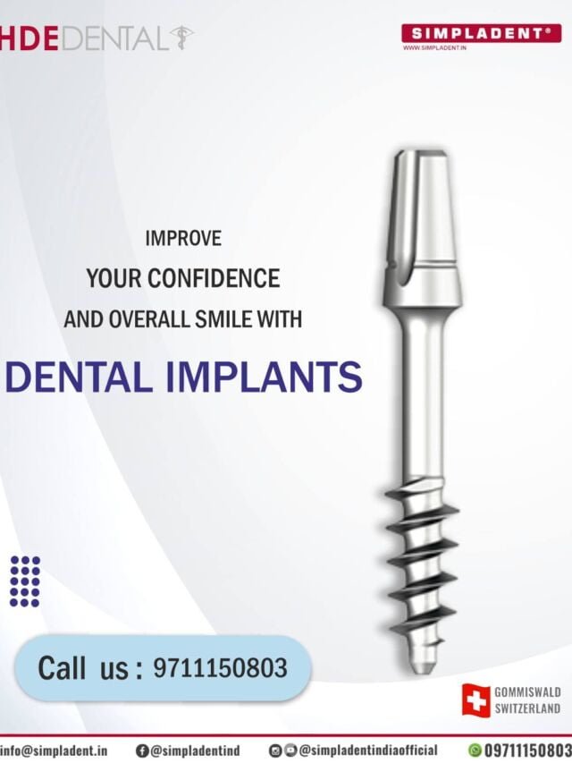 Transform Your Smile with Immediate Loading Implants