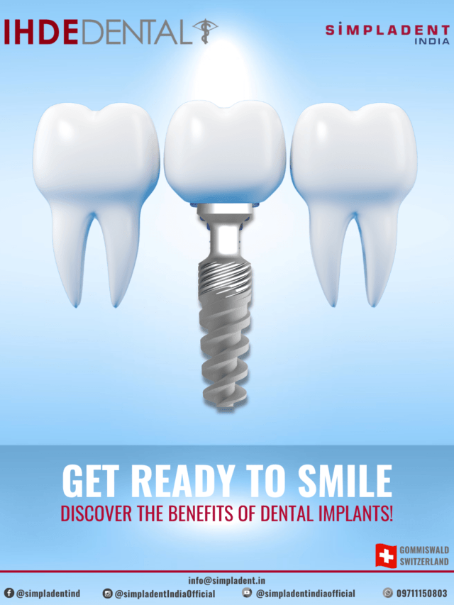 Discover the Power of Innovative Dental Implants