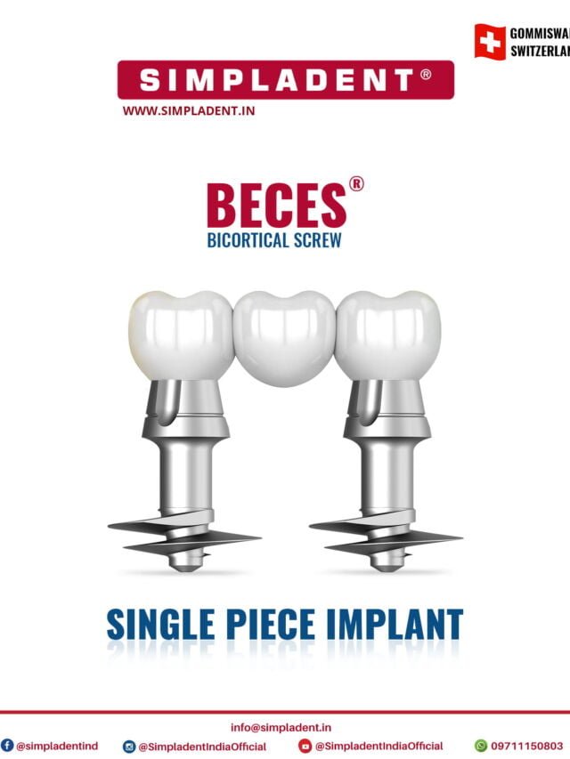Unveiling the Remarkable Benefits of BECES®EX Implants: Transforming Smiles, Transforming Lives
