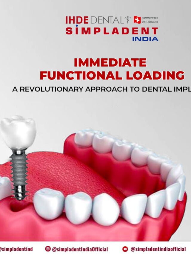 Revitalize Your Smile in Record Time with BECES®EX Implants!