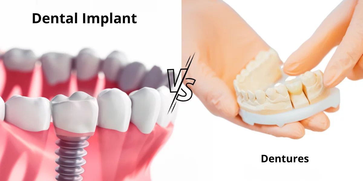 Dental Implants vs Dentures: Choosing the Best Solution for Your Smile Dental Implants or Dentures , choosing dental implants, best dental solutions, dental implant benefits, dentures alternatives