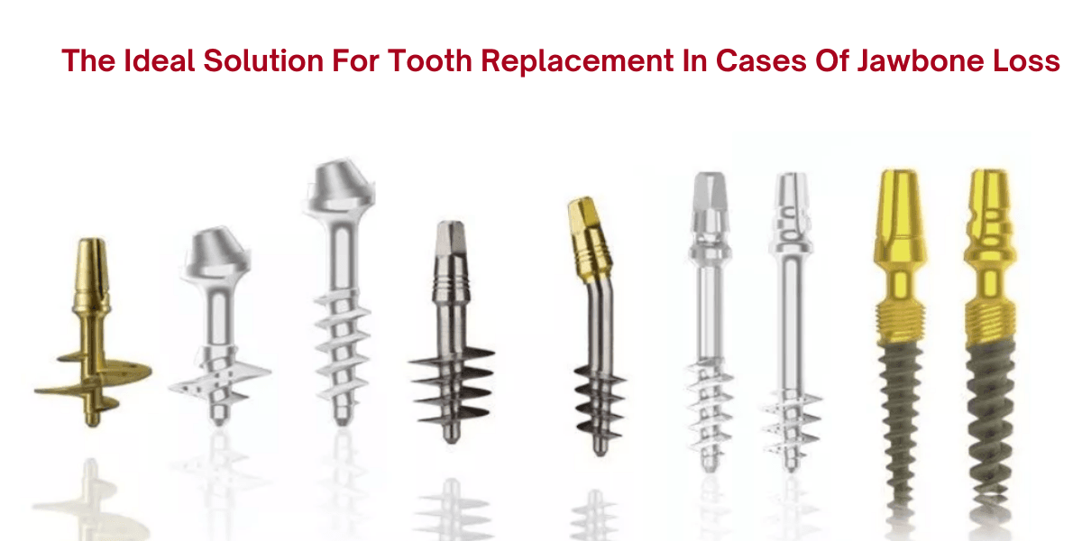 Advanced Corticobasal® Implants procedure for immediate functional loading, innovative dental technology, permanent teeth restoration, reliable implant solutions, cutting-edge implantology techniques.