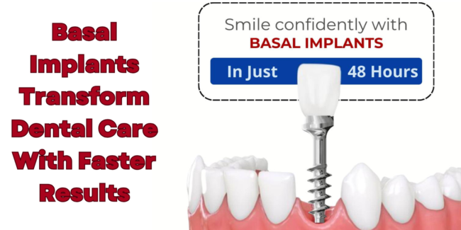 Basal Implants advanced dental solution immediate loading permanent teeth strong jawbone support