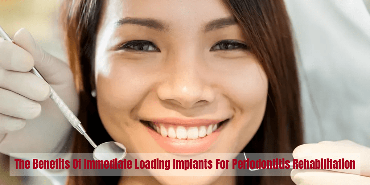 Best Immediate Loading Implants for Same Day Teeth Replacement – Fast, Safe, and Reliable Dental Solutions Immediate Loading Implants Same Day Teeth Dental Implants Fast Recovery Permanent Teeth Solution Painless Dental Procedure