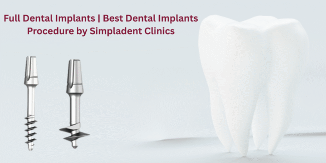 Best dental implants, permanent tooth replacement, affordable dental implants, top dental implant clinic, natural-looking smile restoration