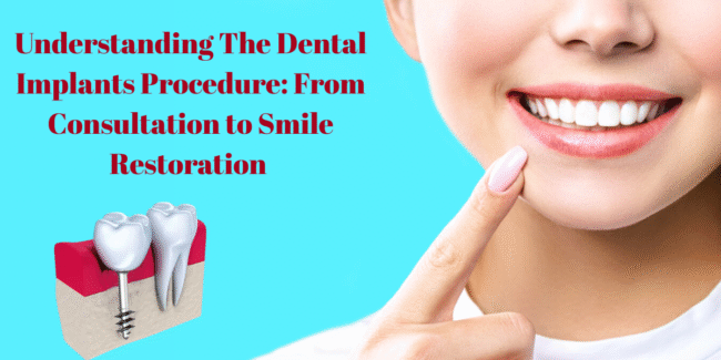 Best Dental Implants – Affordable Permanent Teeth Replacement Solution Dental Implants Treatment, Permanent Teeth Replacement, Best Implant Dentist, Affordable Dental Implants India, Advanced Implant Dentistry