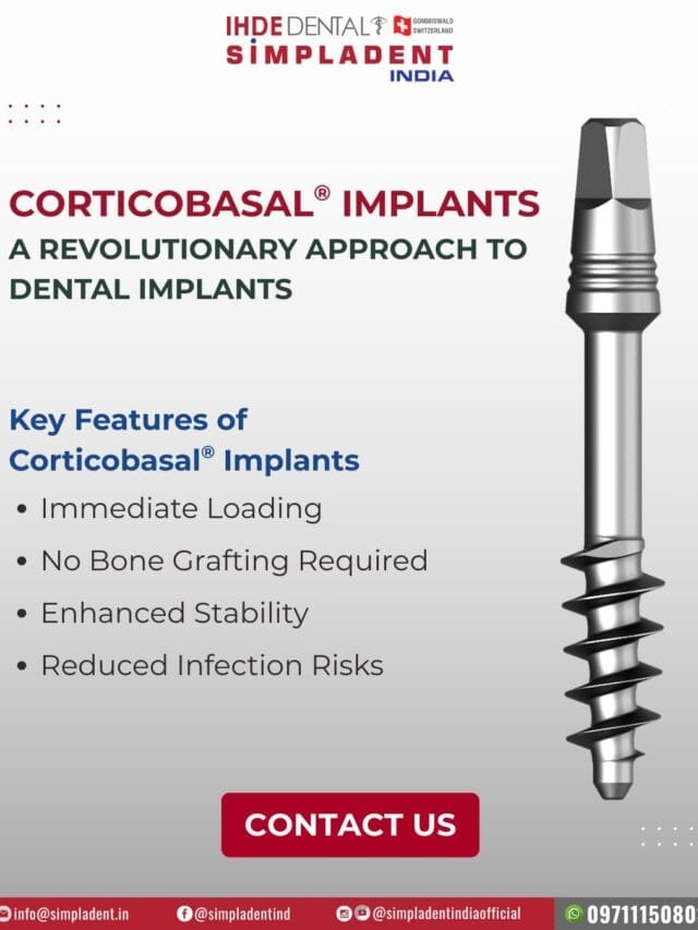 Corticobasal® Implants – A Revolutionary Approach to Dental Implants in Modern Dentistry