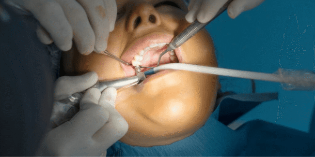 Affordable Dental Implant Surgery | Best Teeth Replacement Clinic Near You Affordable dental implant surgery, permanent teeth replacement, painless tooth implants, best dental implant clinic, advanced implant dentistry procedure, restore smile with implants
