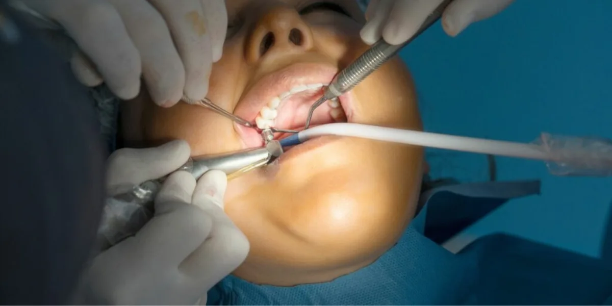 Affordable dental implant surgery, permanent teeth replacement, painless tooth implants, best dental implant clinic, advanced implant dentistry procedure, restore smile with implants