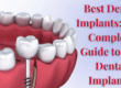 Best dental implants treatment, advanced implant dentistry, permanent teeth solution, top implantologist clinic, premium dental care services.