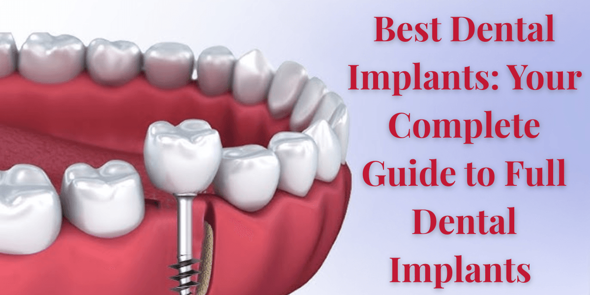 Best dental implants treatment, advanced implant dentistry, permanent teeth solution, top implantologist clinic, premium dental care services.