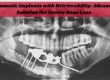 Zygomatic implants procedure, advanced dental implants, full mouth rehabilitation, best implant solution for bone loss, immediate loading implants, expert implant surgeon