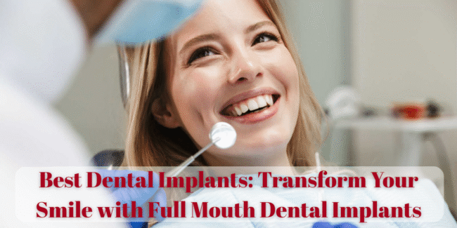 best dental implants, advanced dental implant treatment, permanent teeth replacement, immediate load dental implants, painless dental implants, long lasting dental implants