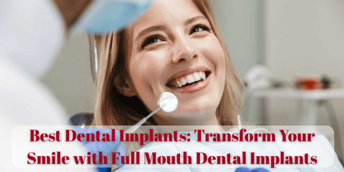 best dental implants, advanced dental implant treatment, permanent teeth replacement, immediate load dental implants, painless dental implants, long lasting dental implants