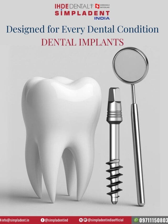 Dental implants treatment, full mouth dental implants, permanent teeth replacement, best dental implant clinic, immediate loading implants, affordable dental implants India