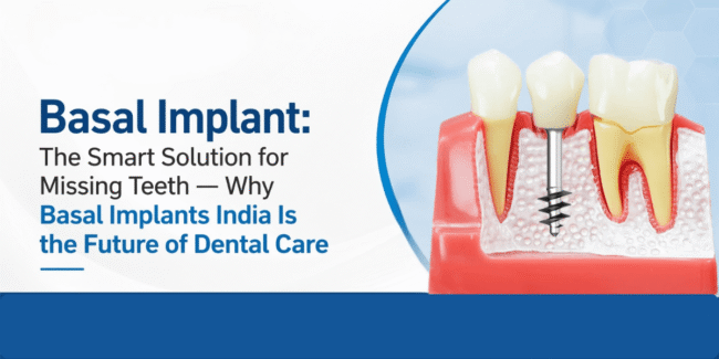 Basal implants India, immediate loading dental implants, full mouth dental implants, painless tooth replacement, advanced basal implant treatment, permanent teeth in 2 days