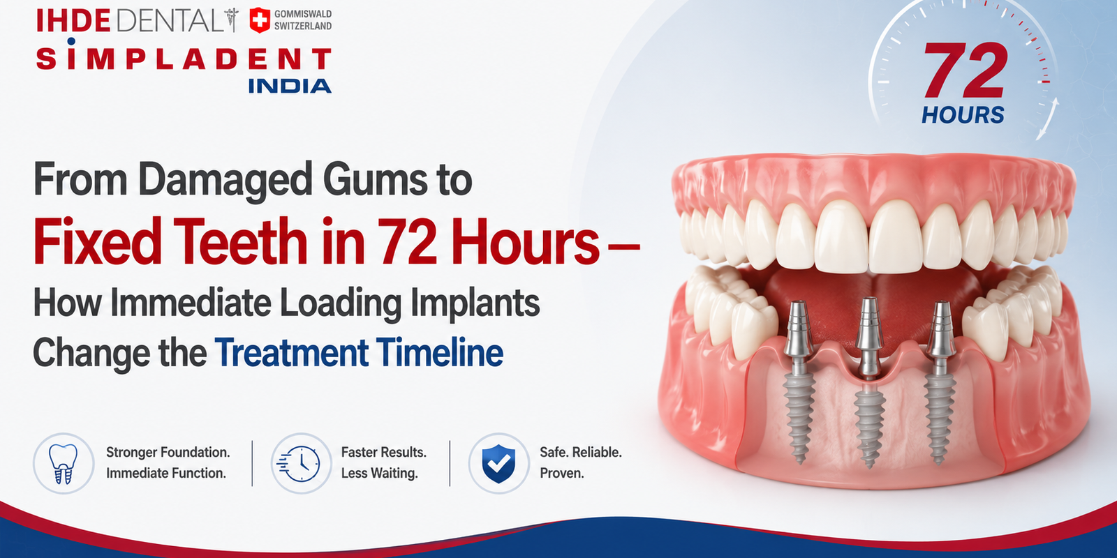 Immediate Loading Implants, same day dental implants, basal implants India, full mouth dental implants, fixed teeth in 72 hours, strategic implantology treatment