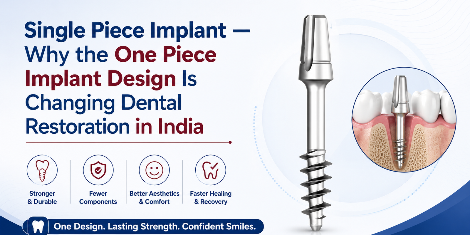 Single Piece Implant treatment