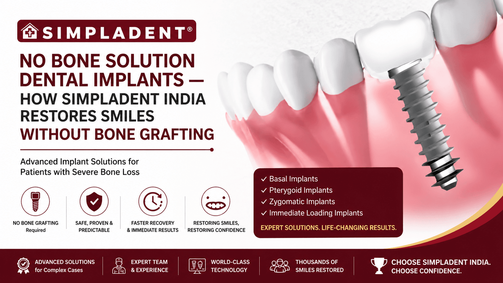 No Bone Solution Dental Implants in India No Bone Solution Dental Implants