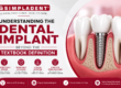 Full Dental Implants treatment for missing teeth