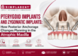 Zygomatic Implants