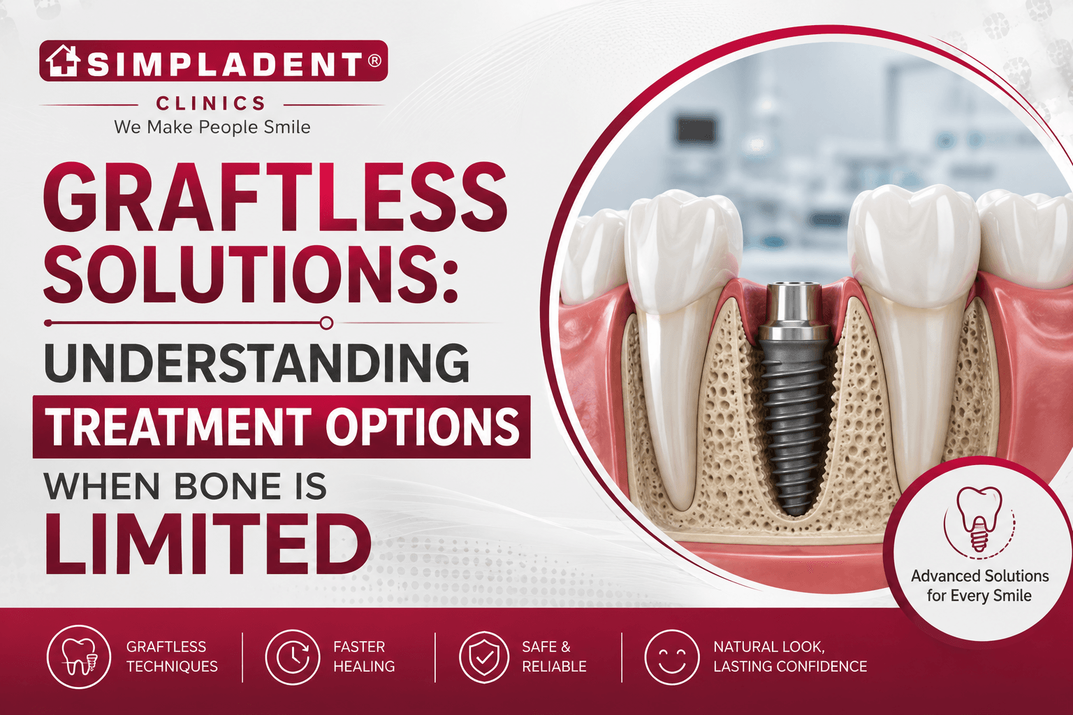 Graftless Solutions for Dental Implants
