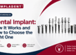 Best dental implants in India